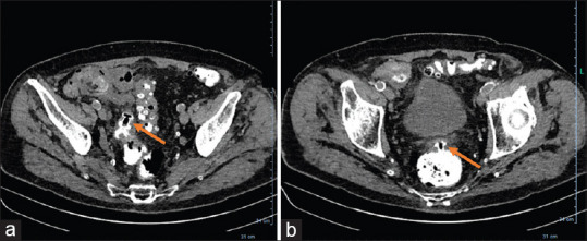 Figure 5