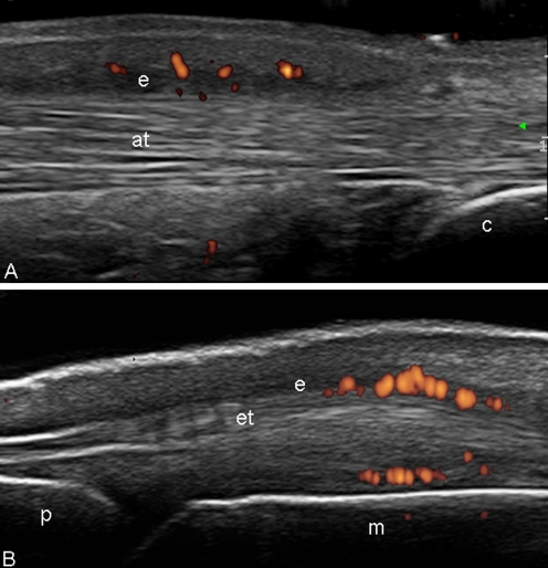 Fig. 4