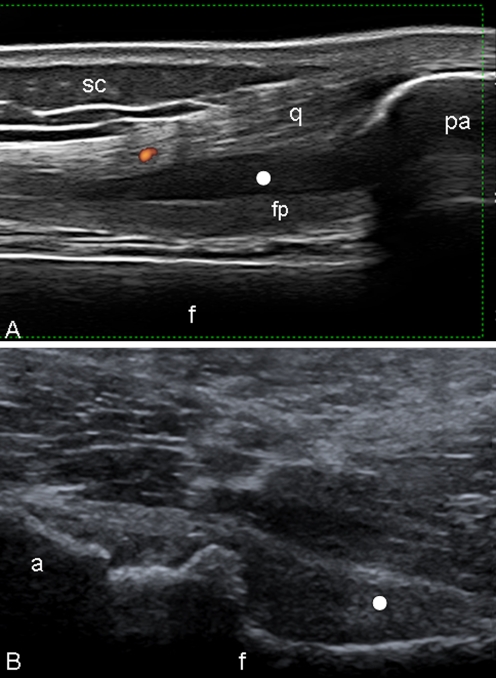 Fig. 2