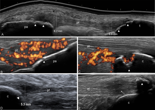 Fig. 6