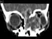 Fig 2.