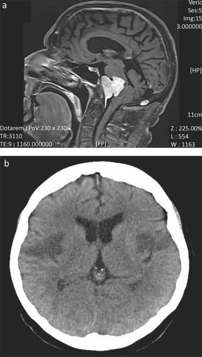 Fig 1.