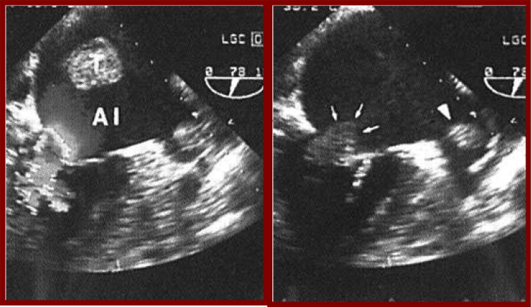 Fig. (5)