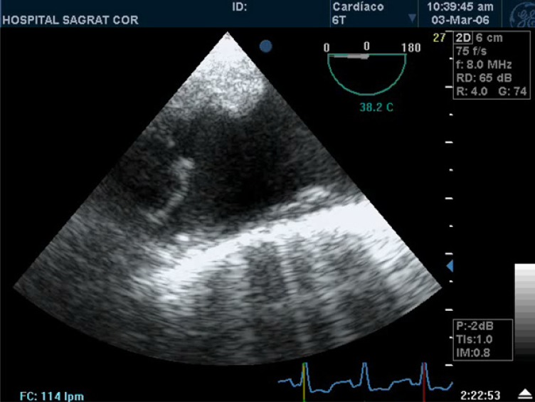 Fig. (7)