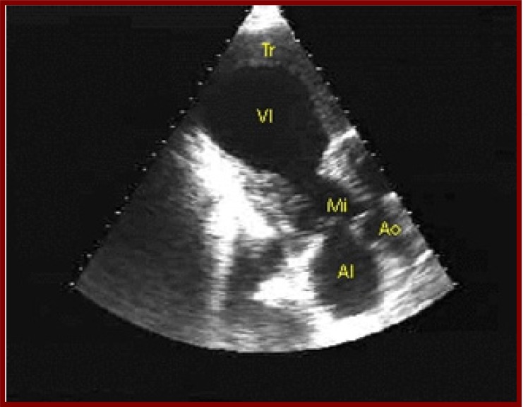 Fig. (4)