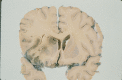 Fig. (1)