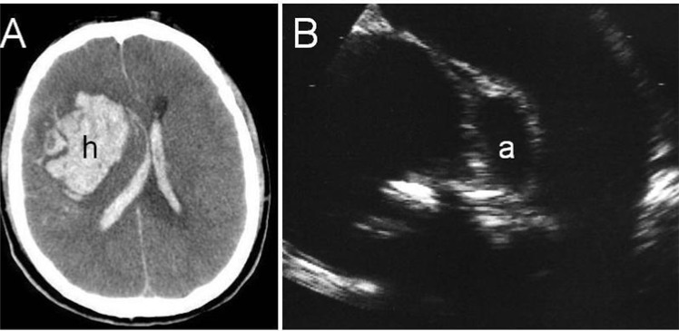 Fig. (6)