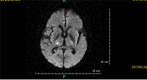 Fig. (2)