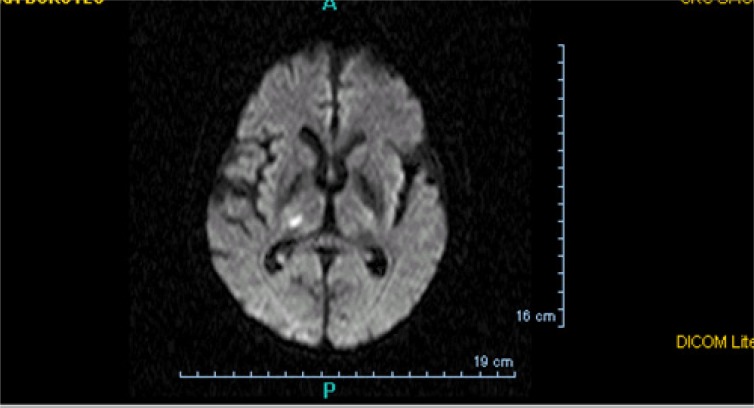 Fig. (2)