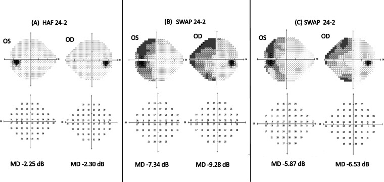 Fig. 2