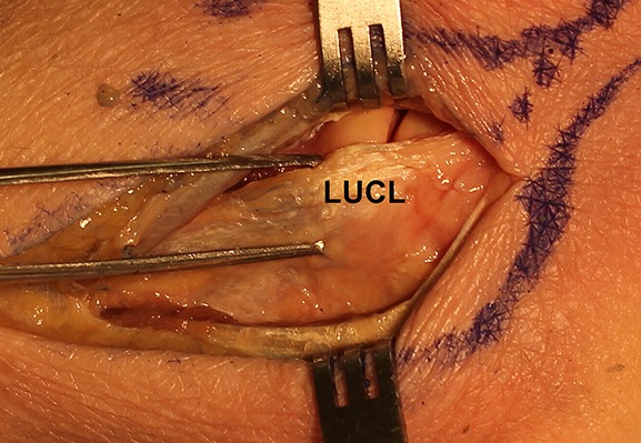 Fig. 4-A