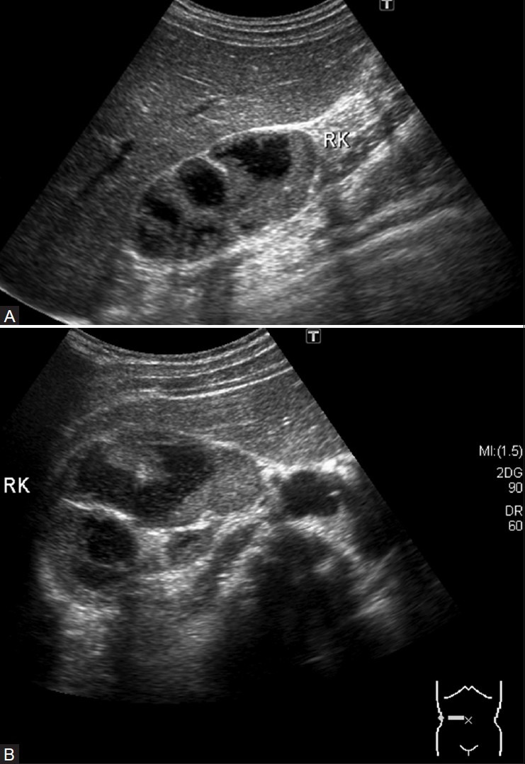 Figure 22 (A, B)