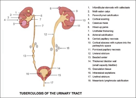 Figure 1A