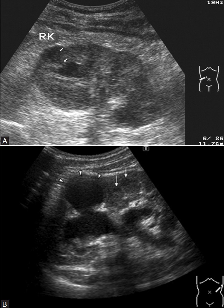 Figure 20 (A, B)