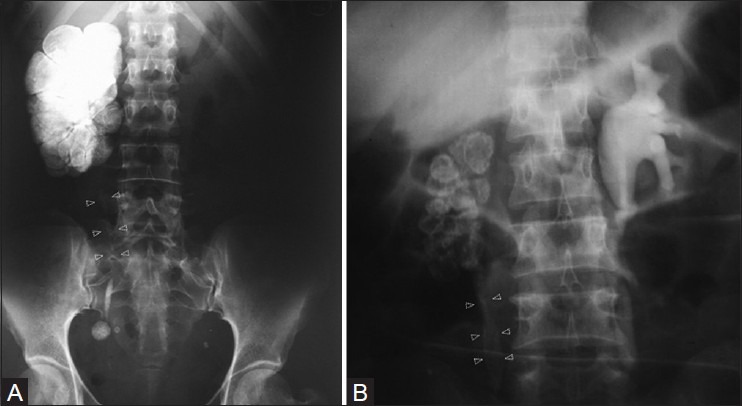 Figure 3 (A, B)