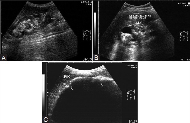 Figure 28