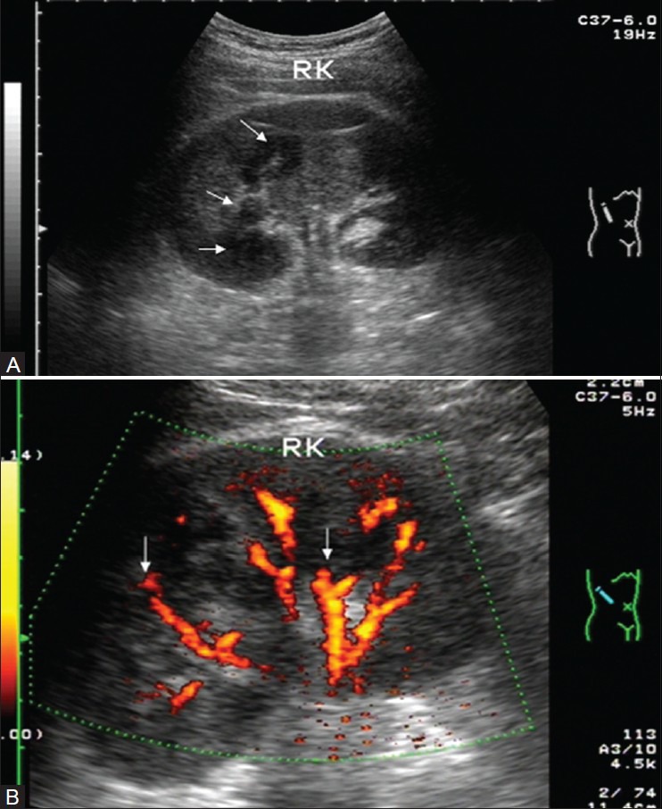 Figure 17 (A, B)