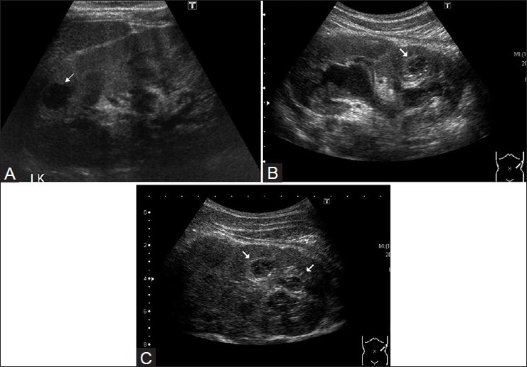 Figure 18 (A-C)