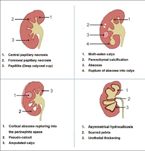 Figure 1B