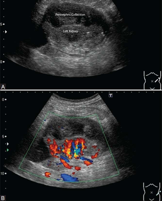 Figure 25