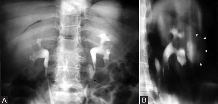 Figure 15 (A, B)