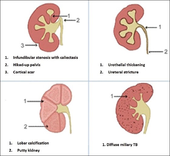 Figure 1C