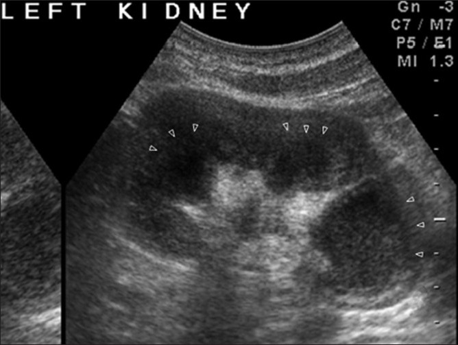 Figure 26