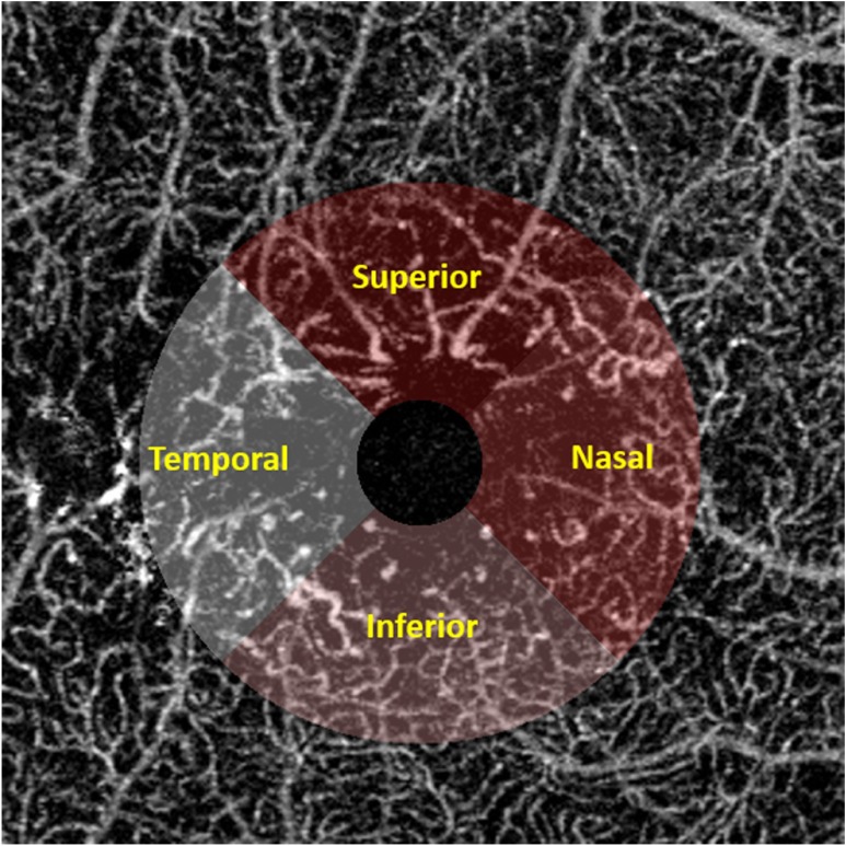 Fig. 12