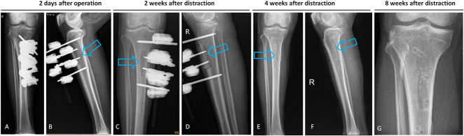 Fig. 3A-G