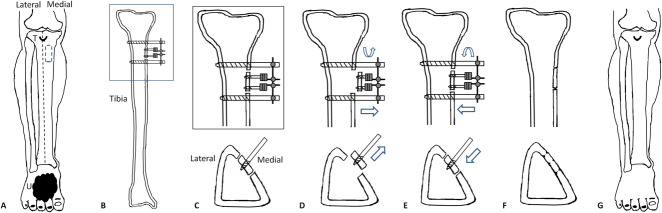 Fig. 1A-G