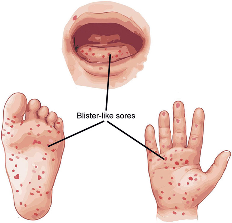 Fig. 2: