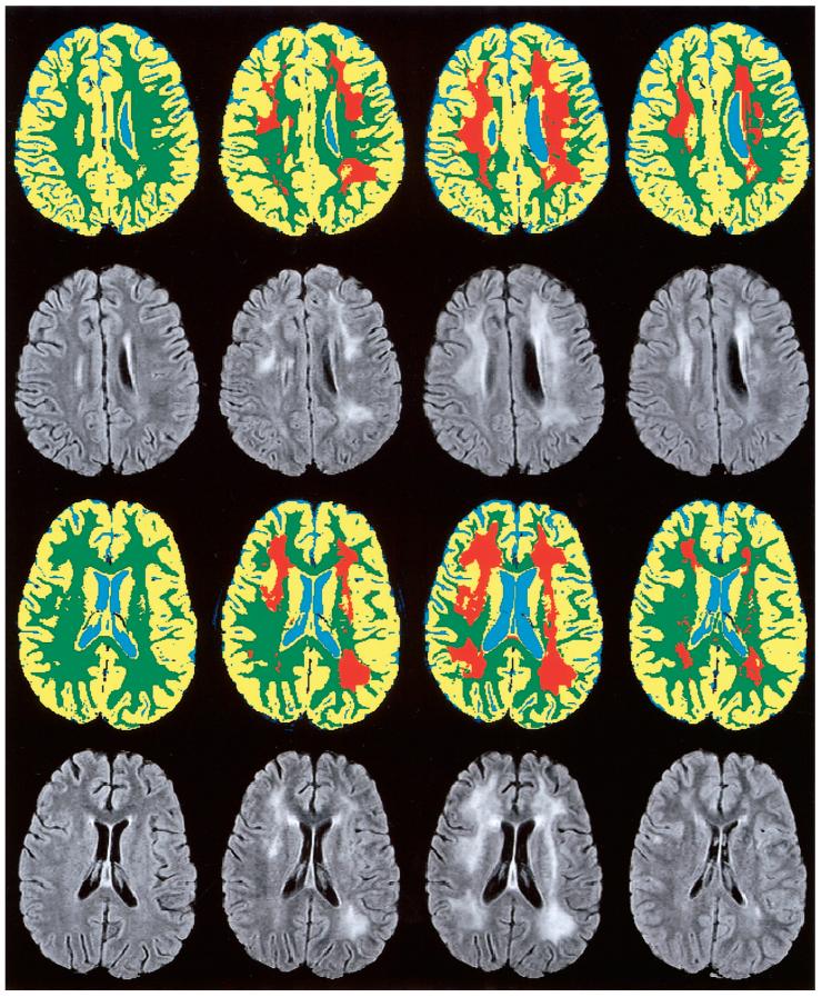 FIG. 4