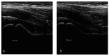 Figure 3. A, B.