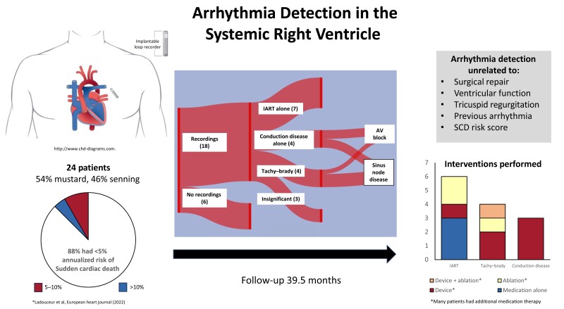 An Unmet Need: Arrhythmia Detection By Implantable Loop Recorder In The 