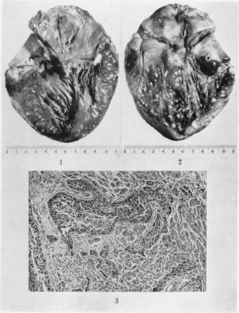 Figs. 1-3