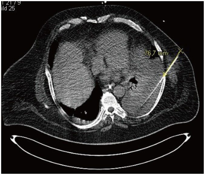 Fig. 4