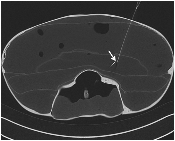 Fig. 3