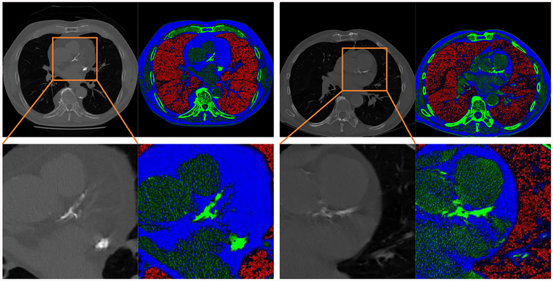 Fig. 2: