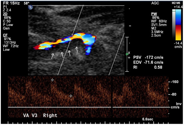 Figure 2.