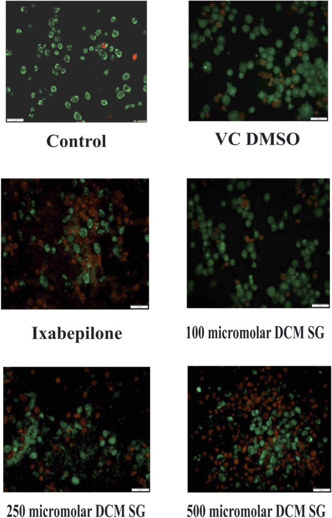 FIGURE 11