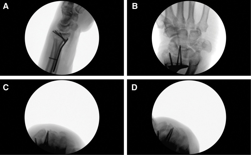 Fig. 5.