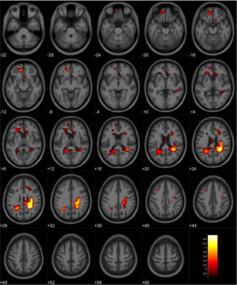 Figure 11