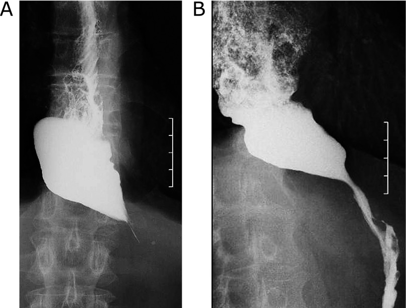 Fig. 1