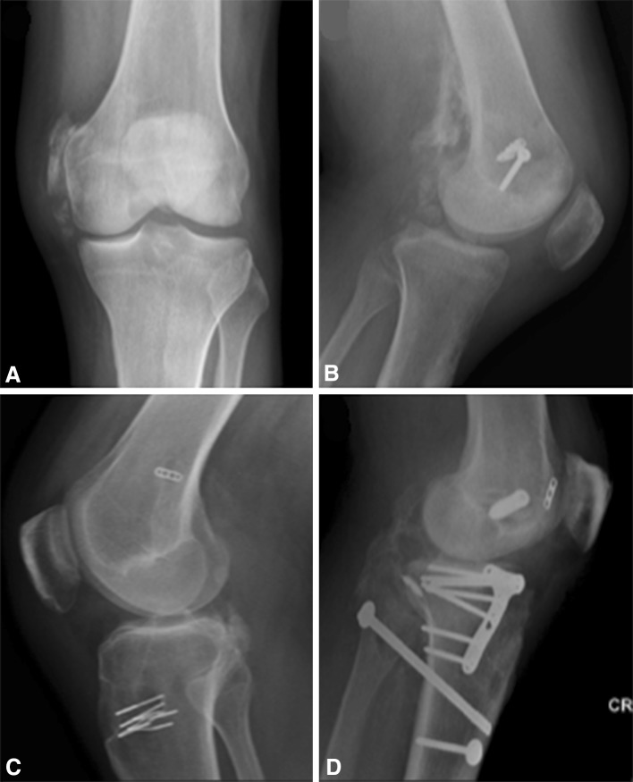 Fig. 1A–D