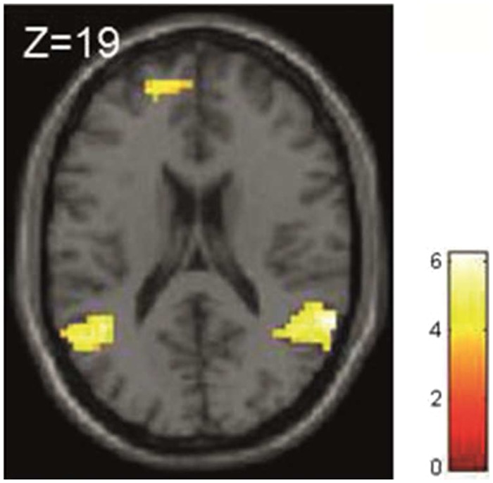 Fig. 4