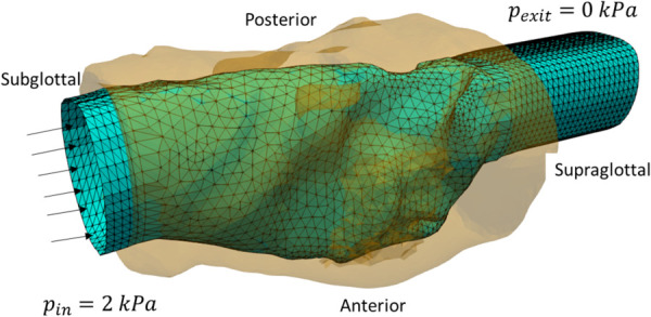 Boundary surface for the flow simulation shown as the triangular mesh, where the inlet and outlet were extended from the extracted lumen surface. The 3D laryngeal tissue model is shown here as a semitransparent structure surrounding the flow domain.