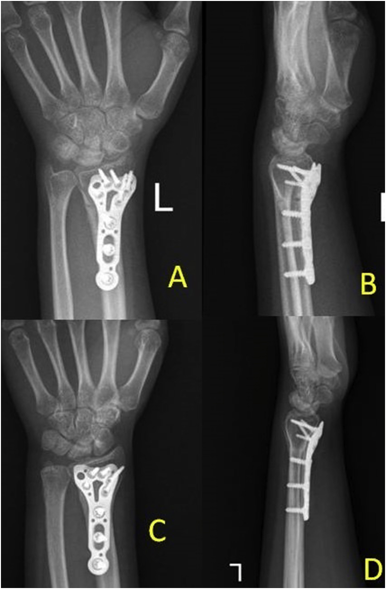 Fig. 3