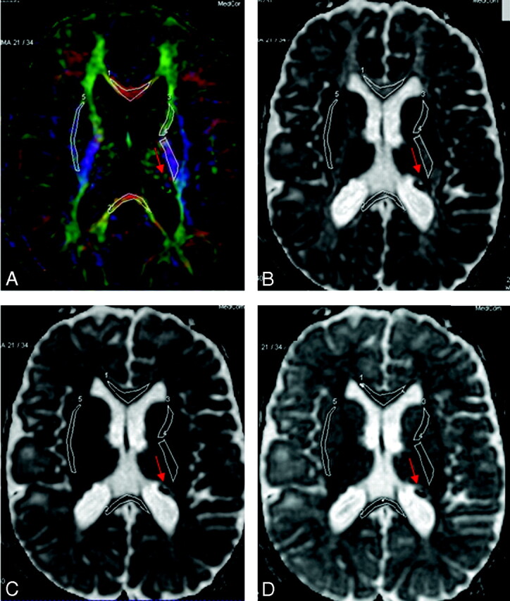 Fig 3.