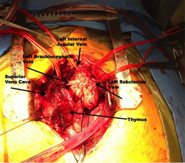 Figure 2: