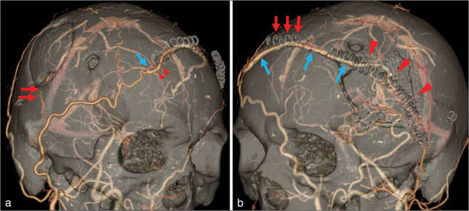 Figure 4: